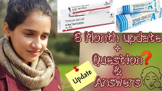 Tretinoin cream 005 results after 2 year and answers of all your questions  best anti aging [upl. by Zoltai]