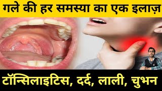 Cure throat infection in 24 hours  Throat pain  Redness  Tonsillitis [upl. by Farrison]