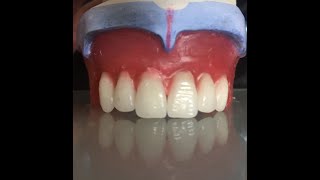 Total Protezlerde Anterior Diş DizimiComple Denture Anterior Teeth Setup [upl. by Hsekar]