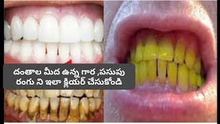 గారపట్టి పచ్చగా ఉన్నదంతాలపైఈచిన్న టిప్ ట్ర్య్ చేయండి దంతాలు తెల్లగా మెరిసెలచేస్తుందిteeth whitening [upl. by Liag]