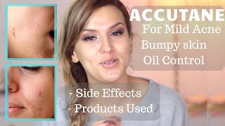 ACCUTANE  ROACCUTANE FOR MILD ACNE OILY SKIN AND STUBBORN SKIN BUMPS  LOW DOSE 20Mg SIDE EFFECTS [upl. by Dammahom510]