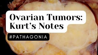 Ovary Tumors Kurt’s Notes pathagonia [upl. by Sidell]