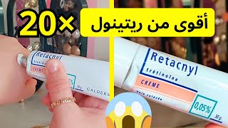 أخيرا جربت كريم retacnyl 005 🤩  كريم ريتاكنيل للوجه  retacnyl [upl. by Yrrab]