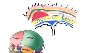 scalp hematomas in neonates [upl. by Jacobba]