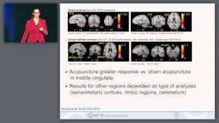 Neuroimaging and Stimulation Studies [upl. by Ayrotal]