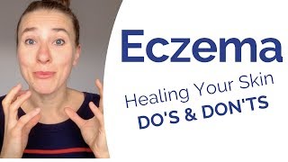 Eczema  What Really Causes It amp Most Powerful Do’s amp Don’t to Start Healing Your Skin Now [upl. by Durwin697]