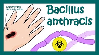 Anthrax Bacillus anthracis  What does Bacillus anthracis do to humans  what is Anthrax [upl. by Otreblon889]