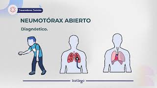 Clase de Medicina Traumatismo torácico  Curso ENARM [upl. by Anelah860]