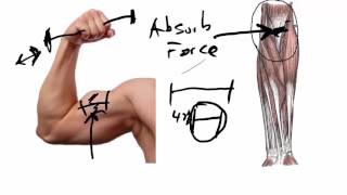 Bicep Tendon Rupture  The Most Important Thing To Know [upl. by Nal]