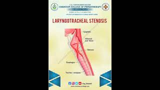 LARYNGOTRACHEAL STENOSIS [upl. by Dewain]