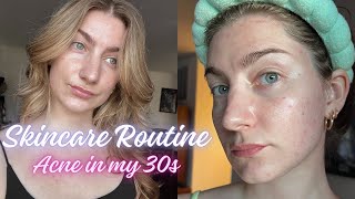 Skincare Routine  Acne in my 30s [upl. by Sairacaz]