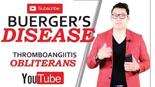 Buergers Disease  Thromboangiitis obliterans [upl. by Gustavo]