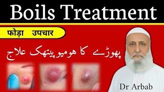 Boils treatment  پھوڑے کا ہومیوپیتھک علاج  Carbuncles Dr Arbab [upl. by Mikaela845]