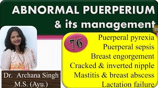 76ABNORMAL PUERPERIUM amp ITS MANAGEMENT Puerperal Pyrexia amp Breast Complications [upl. by Hannej]