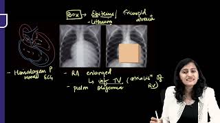 RADIOLOGY RAPID REVISION PART 02 FMGE INICET NEET PG [upl. by Gertrud17]