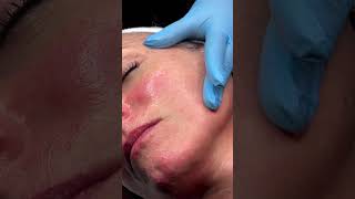 IMAGE Skincare  Dermaplane Facial with IMAGEpro fabbeautyandskin [upl. by Ateuqal588]