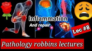 inflammation pathology8inflammation and repair pathology inflammation and repair pathology robbins [upl. by Jit]