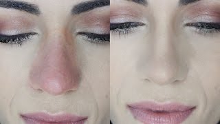 How To Cover Nose REDNESS And MAKE IT LAST  MakeupAndArtfreak [upl. by Godspeed369]