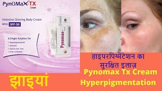 Pynomax TX क्रीम Review Hindi Anti Melasma का ईलाज डॉक्टरो द्वारा बतायी जाने वाली सबसे बेस्ट क्रीम [upl. by Anerec]