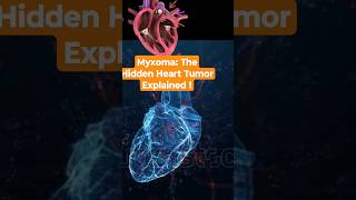 Myxoma The Hidden Heart Tumor Explained shorts shortsfeed hearthealth heart [upl. by Santoro]