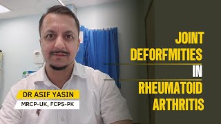 Joint Deformities in Rheumatoid Arthritis  Rheumatology  DR ASIF YASIN mbbs NRE plab fmge [upl. by Geiss911]