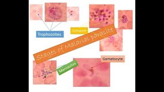 Malarial parasites identification within two minutes  Trophozoite Schizont Gametocyte Merozoite [upl. by Mills]