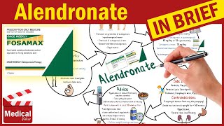 Alendronate Sodium 70 mg Fosamax What is Alendronate used for Fosamax Uses Dosage Side Effects [upl. by Kired47]