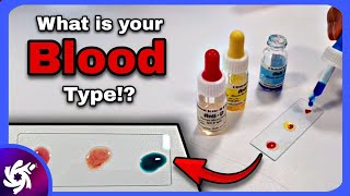 Blood Typing [upl. by Labanna]