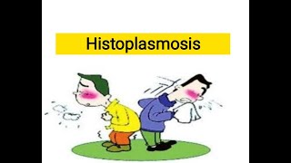 Histoplasmosis chronic Fugal infections [upl. by Reynolds]