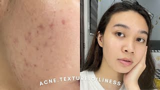 7 Days In Depth Review of Careline Skin Hero Set  Andy Buela Philippines [upl. by Lonne]