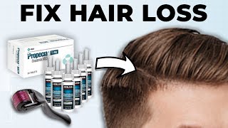 Men How To Fix Hair Loss At Home Full Guide [upl. by Yoko]