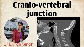 Craniovertebral junction Anatomy and Radiology [upl. by Inaoj]