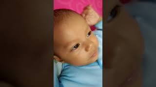 video bayi botak [upl. by Hgielar335]