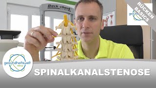 Spinalkanalstenose  Enge im Spinalkanal [upl. by Dulci]