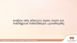 കരളിലെ രണ്ടു കിലോ തൂക്കം വരുന്ന മുഴ  സങ്കീർണ്ണമായ സർജറിയിലൂടെ പുറത്തെടുത്തു [upl. by Atil316]