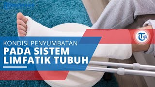 Limfedema Kondisi ketika Terdapat Sumbatan pada Sistem Limfatik Tubuh [upl. by Eelrebmik]