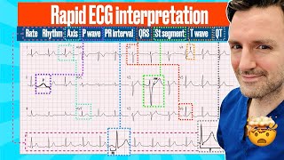 Rapid structured ECG interpretation A visual guide FOR REVISION electrocardiogram [upl. by Naomi]