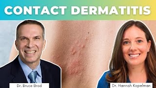 Treating Contact Dermatitis  Dr Bruce Brod [upl. by Leandra245]