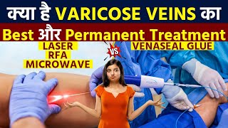 Venaseal Glue or Laser Treatment For Varicose Veins Comparison by Vein Specialist [upl. by Sharleen773]