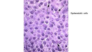 Answers to Basic dermatopathology quiz Dr shashikala krishnamurthy [upl. by Adelia]