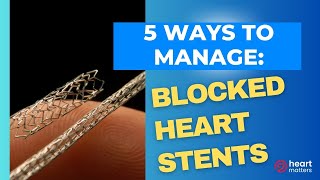 5 ways to manage blocked heart stents [upl. by Nikolia]