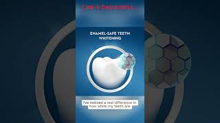 Crest 3D Whitestrips Professional Effects Teeth Whitening Kit – Brilliant White Smile in Just 20 Day [upl. by Negam]