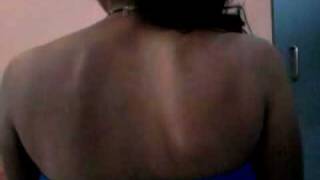 Scapular Winging 1 Winging in shoulder motion [upl. by Ydnew534]