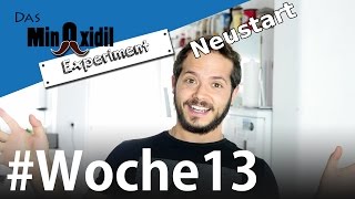 Neustart mit dem Minoxidil Schaum  Das Minoxidil Experiment Woche13 [upl. by Shellie663]