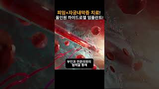 피임자궁내막증 치료 올인원 하이드로젤 임플란트 뉴스 과학 피임 [upl. by Knowle]