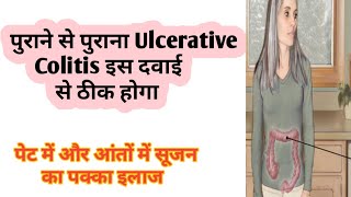 ulcerative colitis Treatment  Diet and yoga  Best Homeopathic medicine for U colitis  dr tarun [upl. by Aguste]