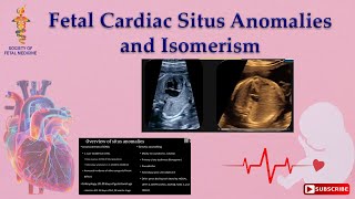 Fetal Cardiac Situs Anomalies and Isomerism [upl. by Chuah]