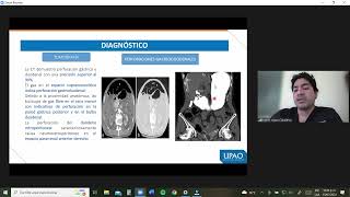 TEMA 30 Abdomen agudo quirúrgico Perforaciones Gastrointestinales y tipos de peritonitis [upl. by Nayek]