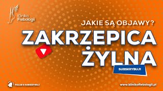 ZAKRZEPICA ŻYLNA  jakie są jej objawy [upl. by Henrie386]