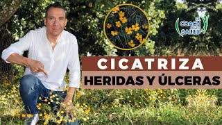 Cómo cicatrizar heridas y úlceras en adultos [upl. by Cece828]